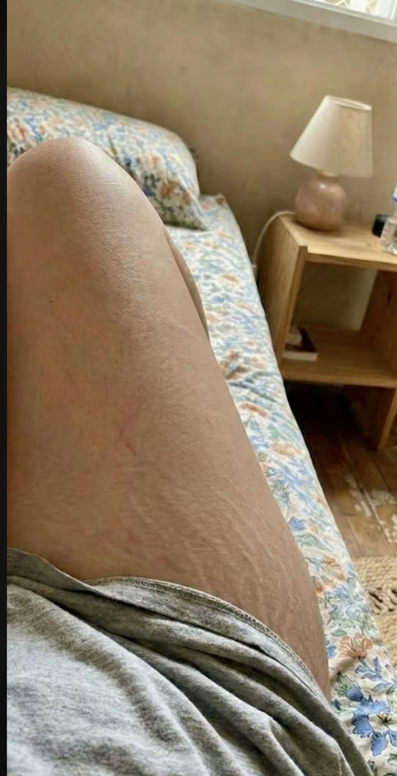 Depois do uso de SunBun